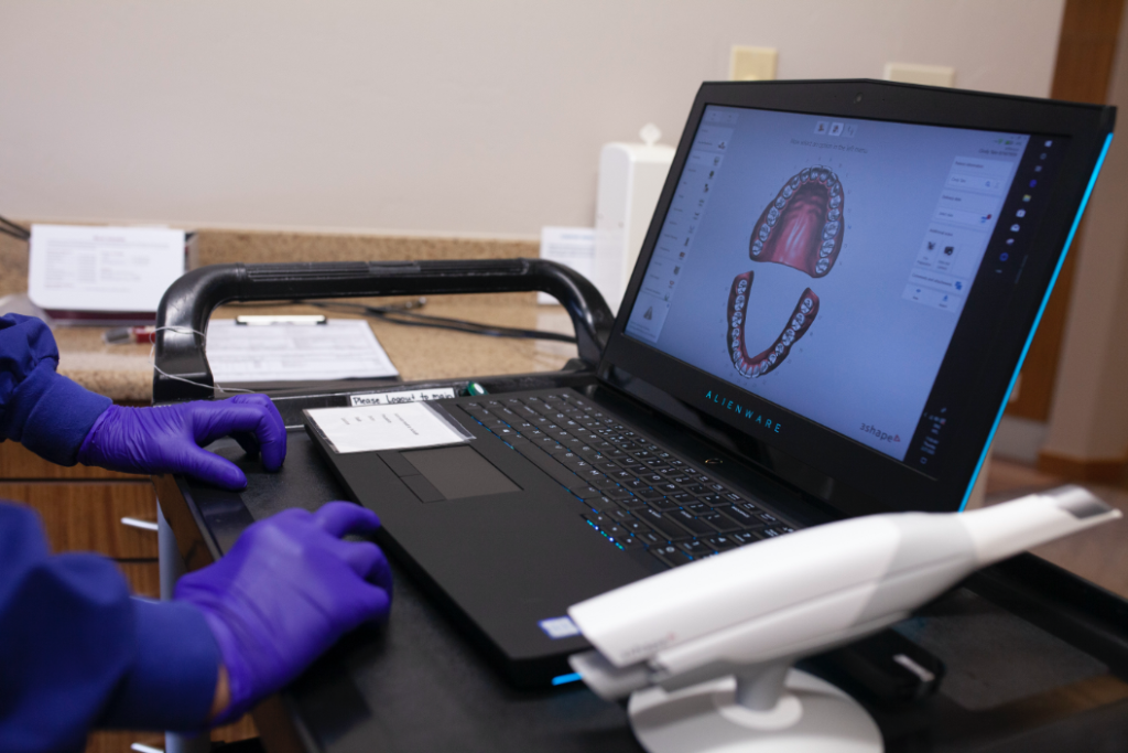 digital impression system showing scanned mouth