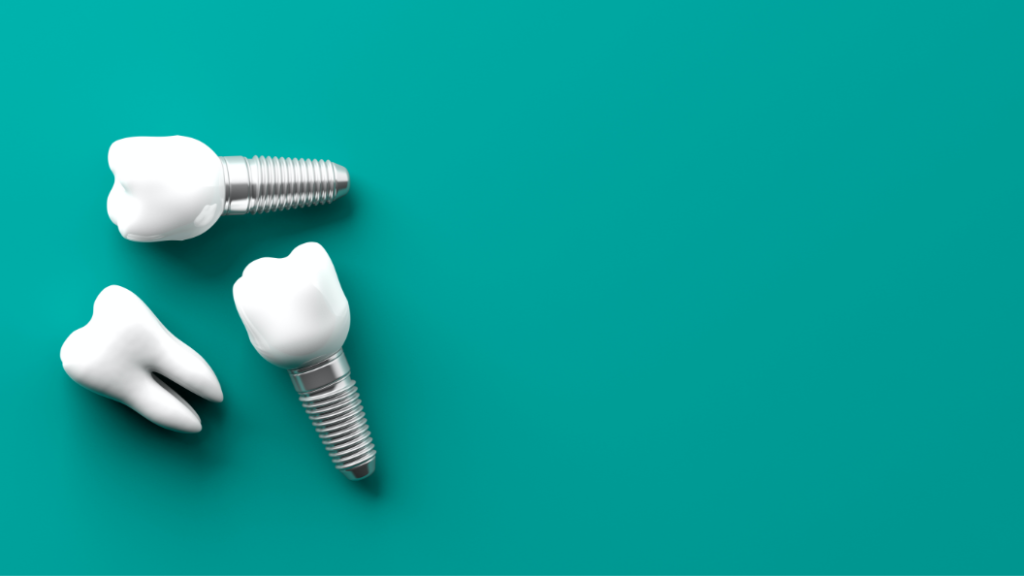 individual teeth implants