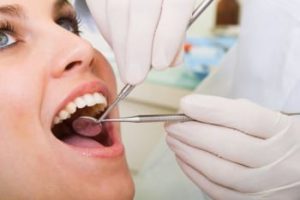 dental sealants